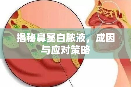 揭秘鼻竇白膿液，成因與應(yīng)對策略