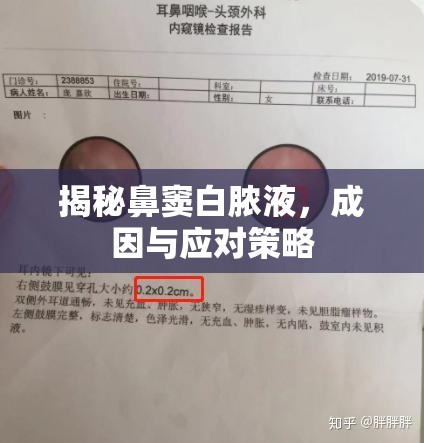 揭秘鼻竇白膿液，成因與應(yīng)對策略