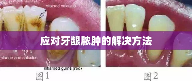 應(yīng)對牙齦膿腫的解決方法