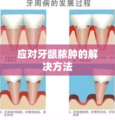 應(yīng)對牙齦膿腫的解決方法