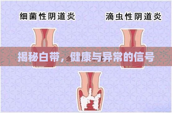 揭秘白帶，健康與異常的信號