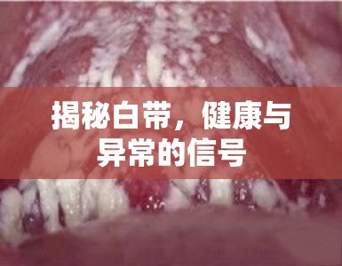 揭秘白帶，健康與異常的信號