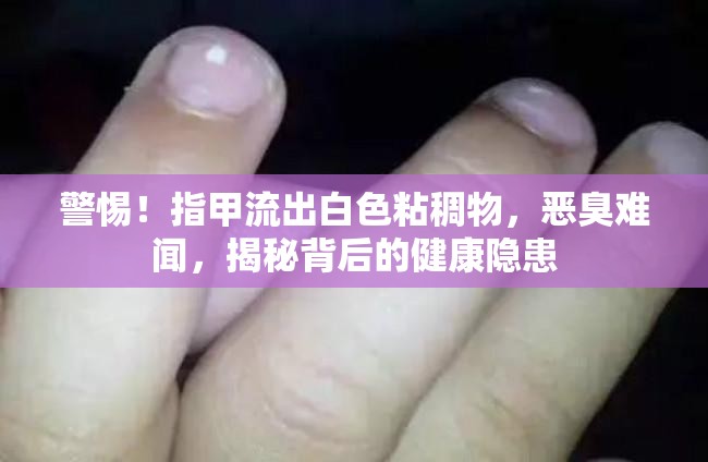 警惕！指甲流出白色粘稠物，惡臭難聞，揭秘背后的健康隱患