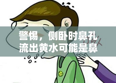 警惕，側(cè)臥時(shí)鼻孔流出黃水可能是鼻竇炎的信號(hào)