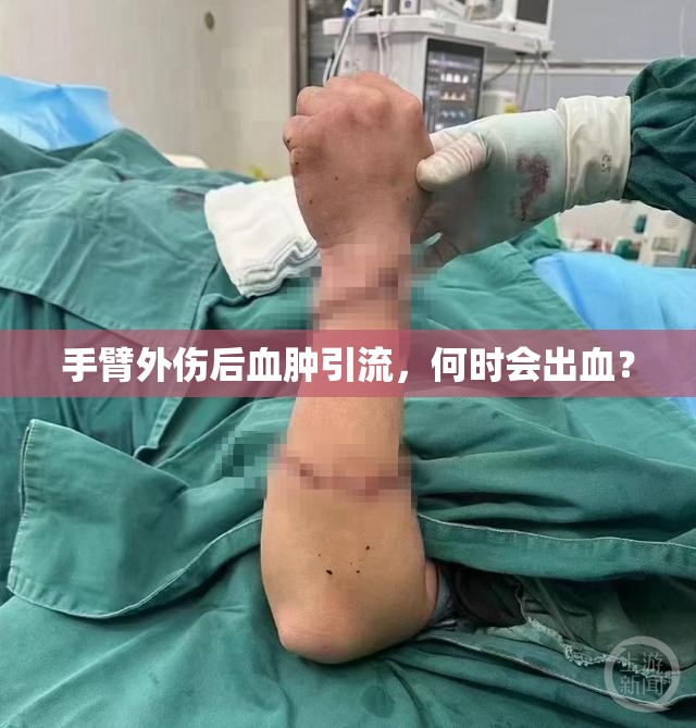 手臂外傷后血腫引流，何時會出血？
