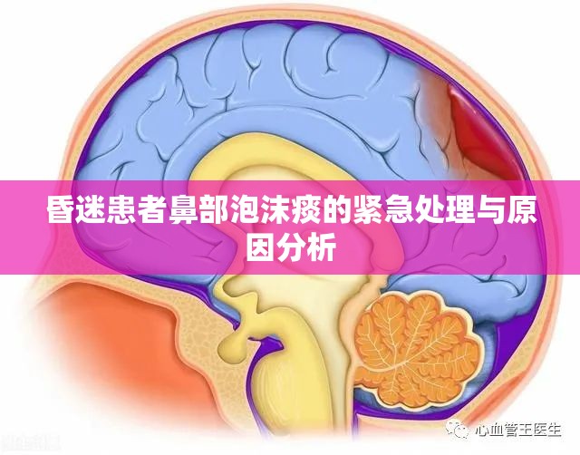 昏迷患者鼻部泡沫痰的緊急處理與原因分析