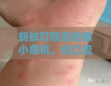 螞蟻叮咬后的微小危機(jī)，傷口流水的處理與預(yù)防