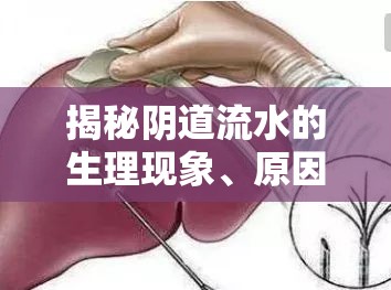 揭秘陰道流水的生理現(xiàn)象、原因及注意事項(xiàng)