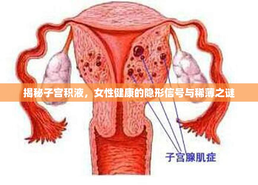 揭秘子宮積液，女性健康的隱形信號(hào)與稀薄之謎