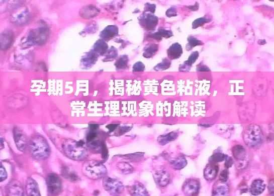 孕期5月，揭秘黃色粘液，正常生理現(xiàn)象的解讀