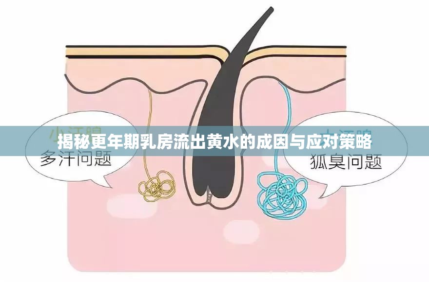 揭秘更年期乳房流出黃水的成因與應(yīng)對(duì)策略