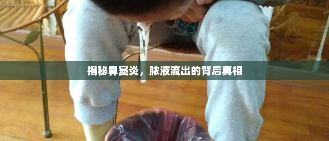 揭秘鼻竇炎，膿液流出的背后真相