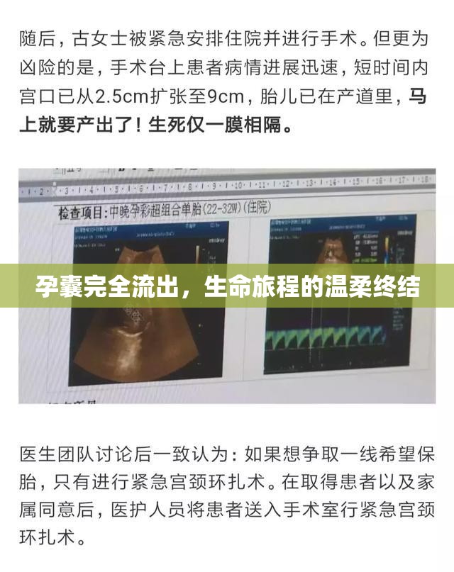 孕囊完全流出，生命旅程的溫柔終結(jié)