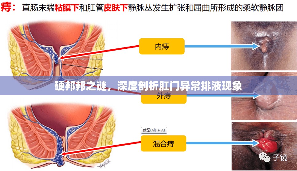 硬邦邦之謎，深度剖析肛門(mén)異常排液現(xiàn)象