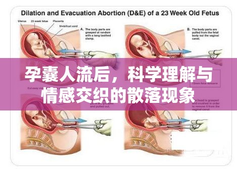 孕囊人流后，科學(xué)理解與情感交織的散落現(xiàn)象