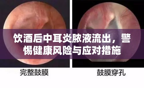 飲酒后中耳炎膿液流出，警惕健康風(fēng)險(xiǎn)與應(yīng)對措施