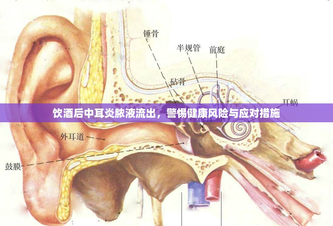 飲酒后中耳炎膿液流出，警惕健康風(fēng)險(xiǎn)與應(yīng)對措施