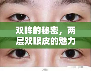 雙眸的秘密，兩層雙眼皮的魅力輪舞