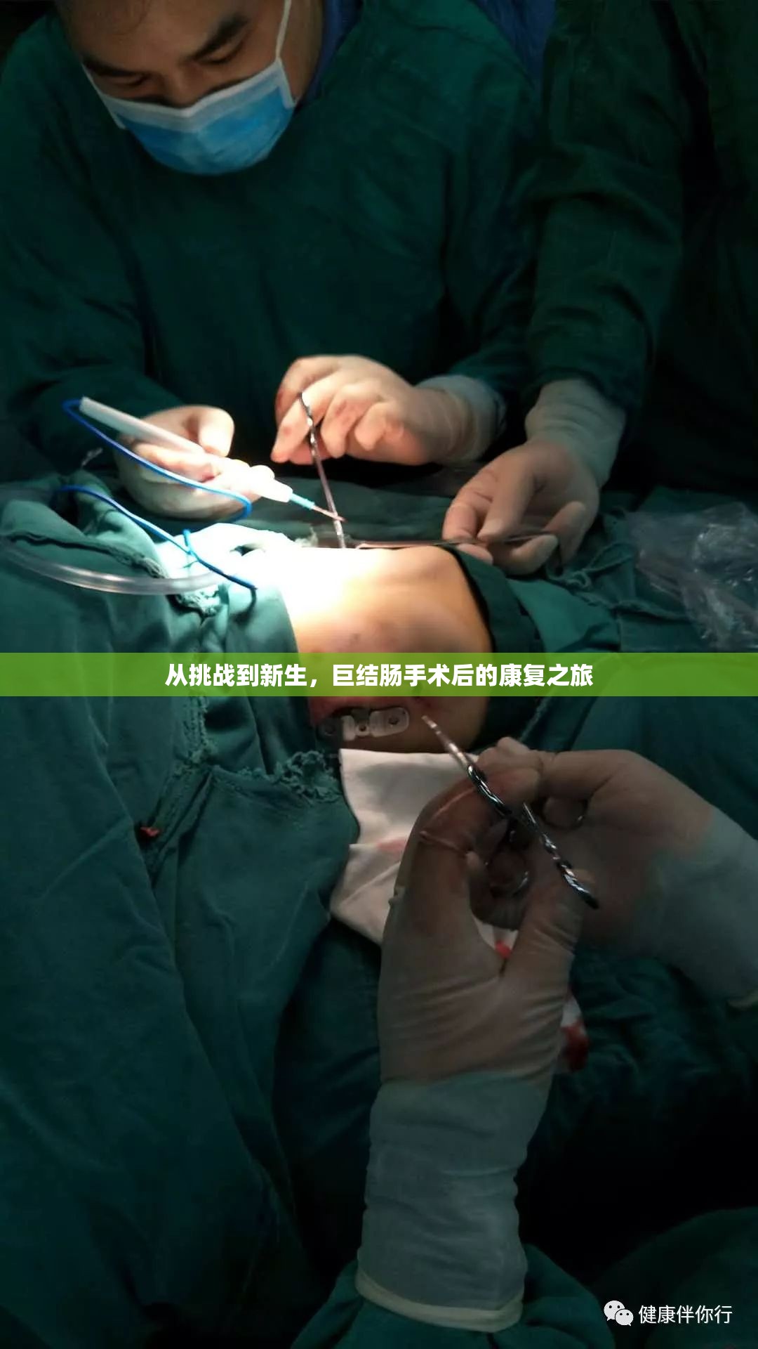 從挑戰(zhàn)到新生，巨結(jié)腸手術(shù)后的康復(fù)之旅