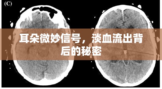 耳朵微妙信號，淡血流出背后的秘密