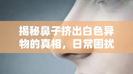 揭秘鼻子擠出白色異物的真相，日常困擾還是健康警報？