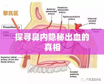 探尋鼻內(nèi)隱秘出血的真相