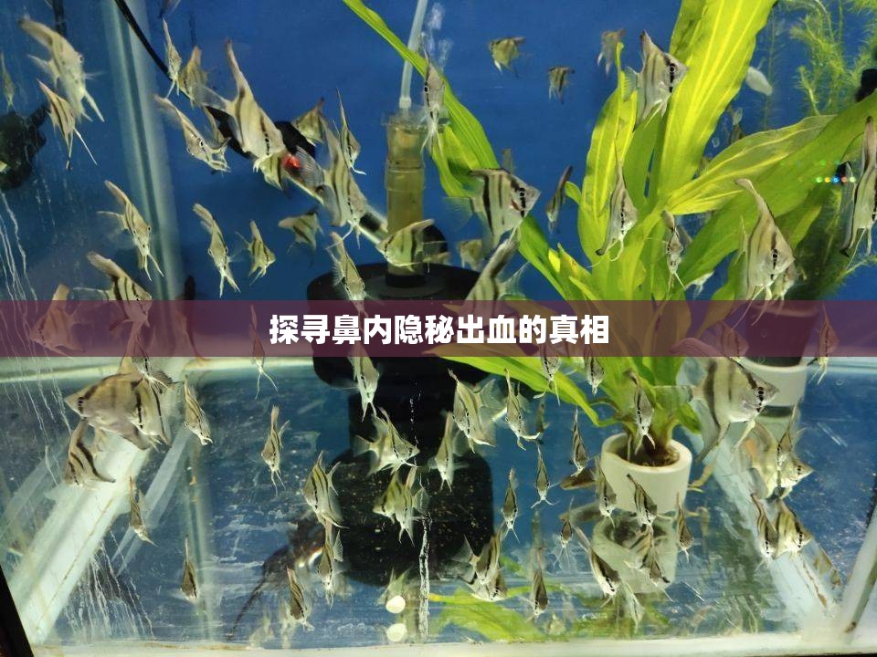 探尋鼻內(nèi)隱秘出血的真相