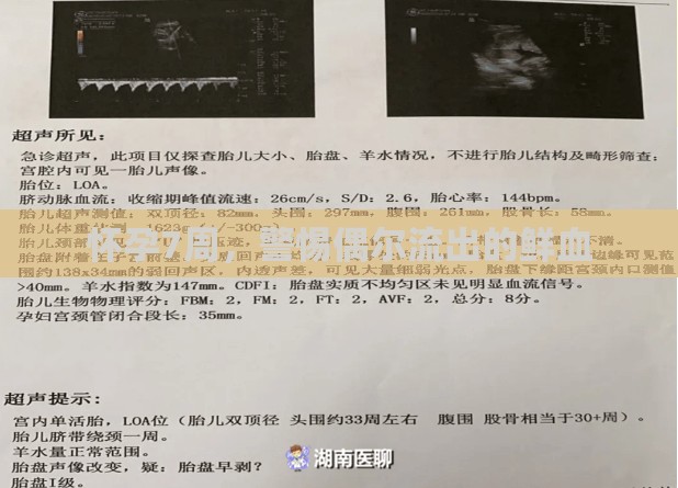 懷孕7周，警惕偶爾流出的鮮血