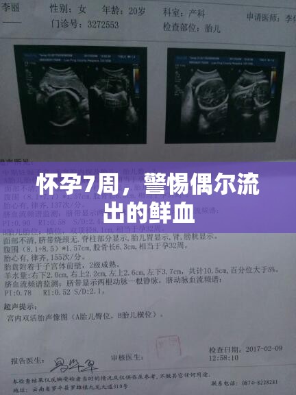 懷孕7周，警惕偶爾流出的鮮血