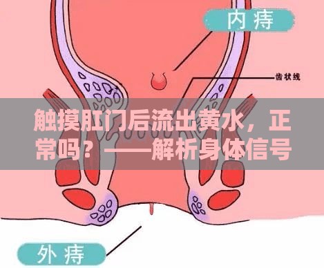 觸摸肛門(mén)后流出黃水，正常嗎？——解析身體信號(hào)的真相