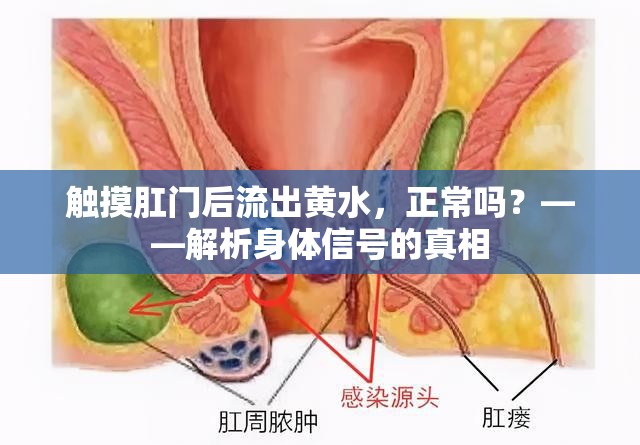 觸摸肛門(mén)后流出黃水，正常嗎？——解析身體信號(hào)的真相