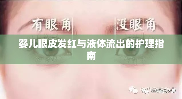 嬰兒眼皮發(fā)紅與液體流出的護理指南