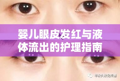 嬰兒眼皮發(fā)紅與液體流出的護理指南