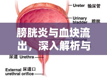 膀胱炎與血塊流出，深入解析與應(yīng)對策略