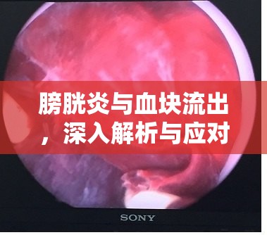 膀胱炎與血塊流出，深入解析與應(yīng)對策略