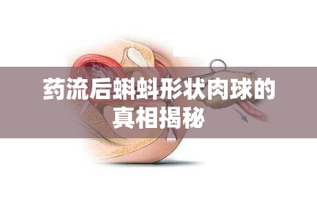藥流后蝌蚪形狀肉球的真相揭秘