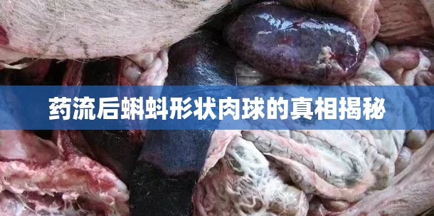 藥流后蝌蚪形狀肉球的真相揭秘