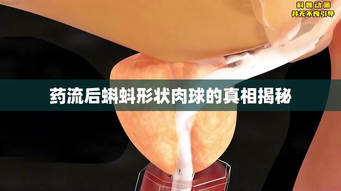 藥流后蝌蚪形狀肉球的真相揭秘