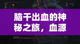 腦干出血的神秘之旅，血源、路徑與治療