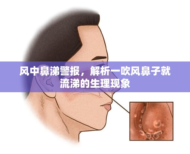 風(fēng)中鼻涕警報(bào)，解析一吹風(fēng)鼻子就流涕的生理現(xiàn)象