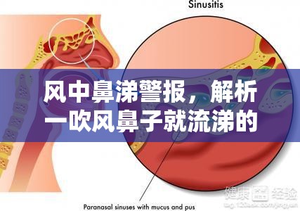 風(fēng)中鼻涕警報(bào)，解析一吹風(fēng)鼻子就流涕的生理現(xiàn)象