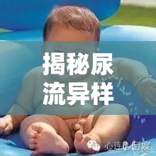 揭秘尿流異樣，日常不適背后的健康真相與警報(bào)