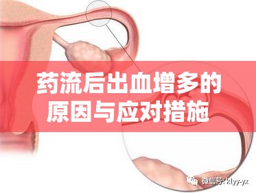 藥流后出血增多的原因與應(yīng)對(duì)措施