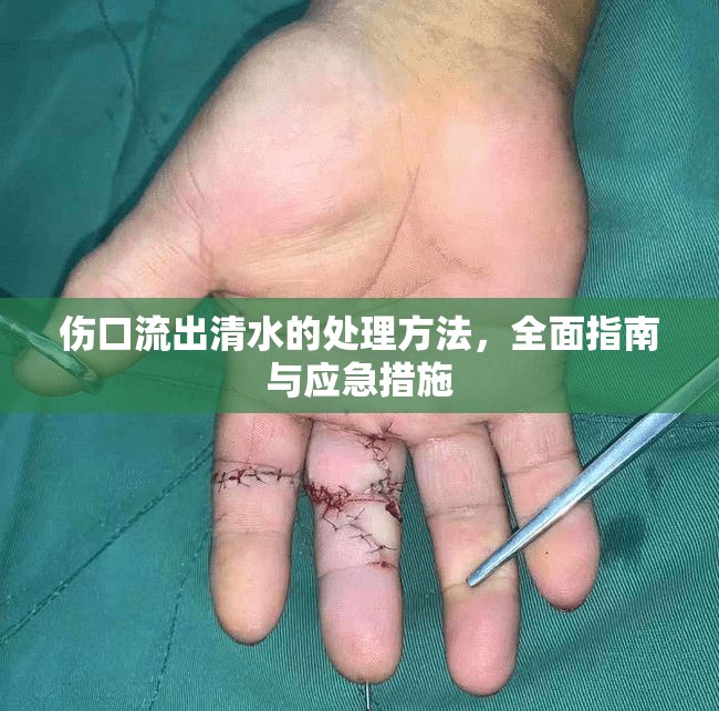 傷口流出清水的處理方法，全面指南與應急措施