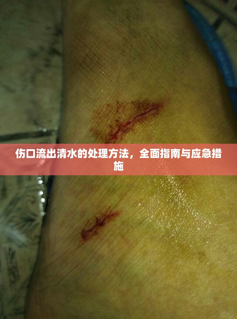 傷口流出清水的處理方法，全面指南與應急措施