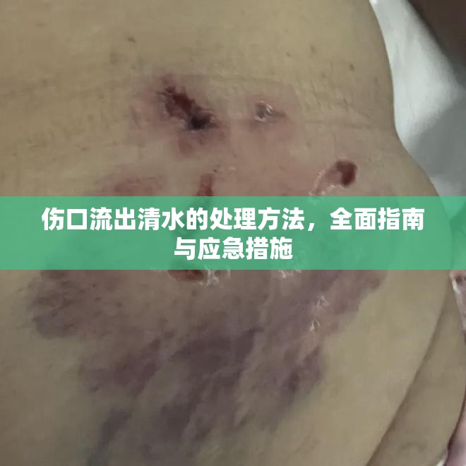 傷口流出清水的處理方法，全面指南與應急措施