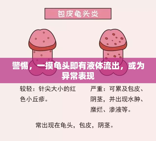 警惕，一摸龜頭即有液體流出，或?yàn)楫惓１憩F(xiàn)