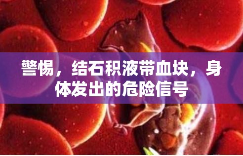 警惕，結(jié)石積液帶血塊，身體發(fā)出的危險信號