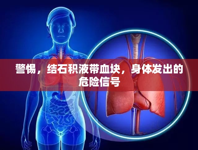 警惕，結(jié)石積液帶血塊，身體發(fā)出的危險信號