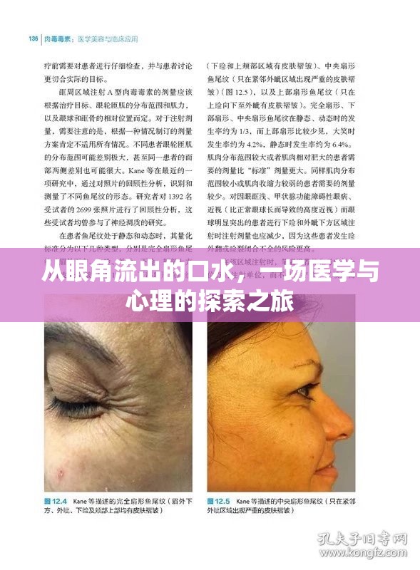從眼角流出的口水，一場(chǎng)醫(yī)學(xué)與心理的探索之旅